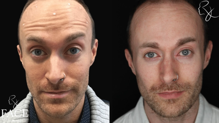 neuromodulators2-forward