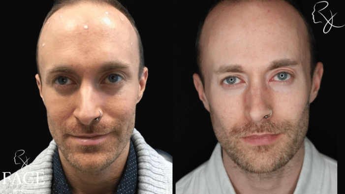 neuromodulators2-forward2